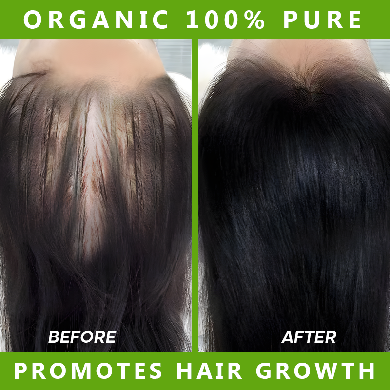 Private Label Organic Vitamin E Scalp Care Products Rosemary Hair Nourishing Moisturizing Batana Hair Growth Oil for Women