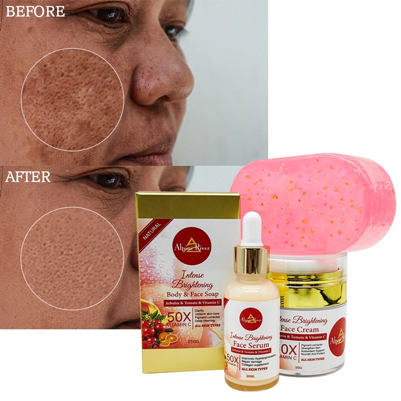 Private Label Luxury Korean Beauty Product Arbutin Skin Whitening and Exfoliating 24k Gold Soap Tomato Skin Care Set for Women