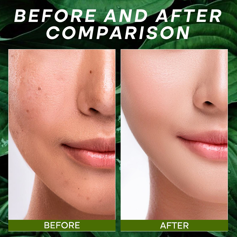 Private Labels Vitamin C Skin Care Exfoliating Tea Tree Handmade Soap Bath Soap for Anti-Acne