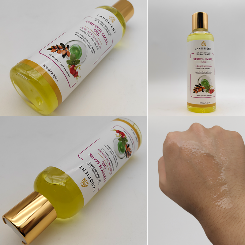 Private Label Natural Organic Vitamin C Skin Revitalizing Stretch Mark Removal Oil Skin Moisturizing Stretch Mark Oil for Women