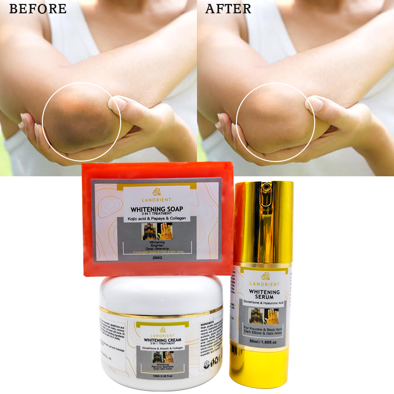 Private Label Korean Skin Beauty Products Natural Organic Vitamin C Knuckle Whitening Remove Dark Spots Skin Care Set for Women