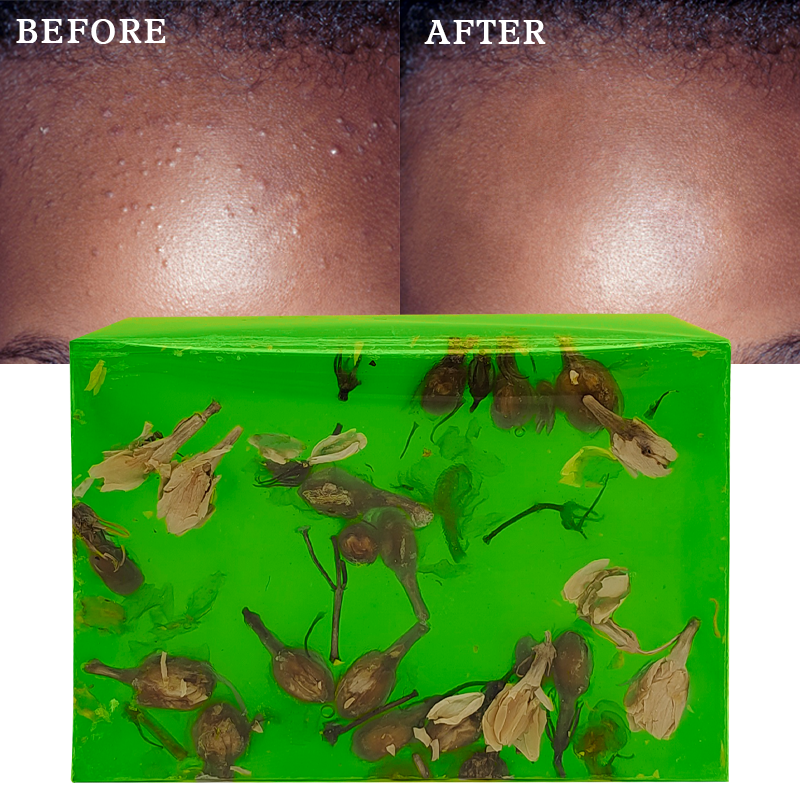 Private Label Vitamin C Skin Care Exfoliating Deep Cleansing Acne Remover Tea Tree Soap Dark Spot Removal Handmade Soap Bar