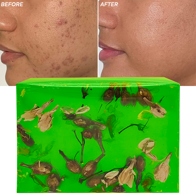 OEM Wholesale Organic Skin Care Bath Products Tea Tree Blackhead Removing Moisturizing Soap Bar Deep Cleansing Handmade Soap