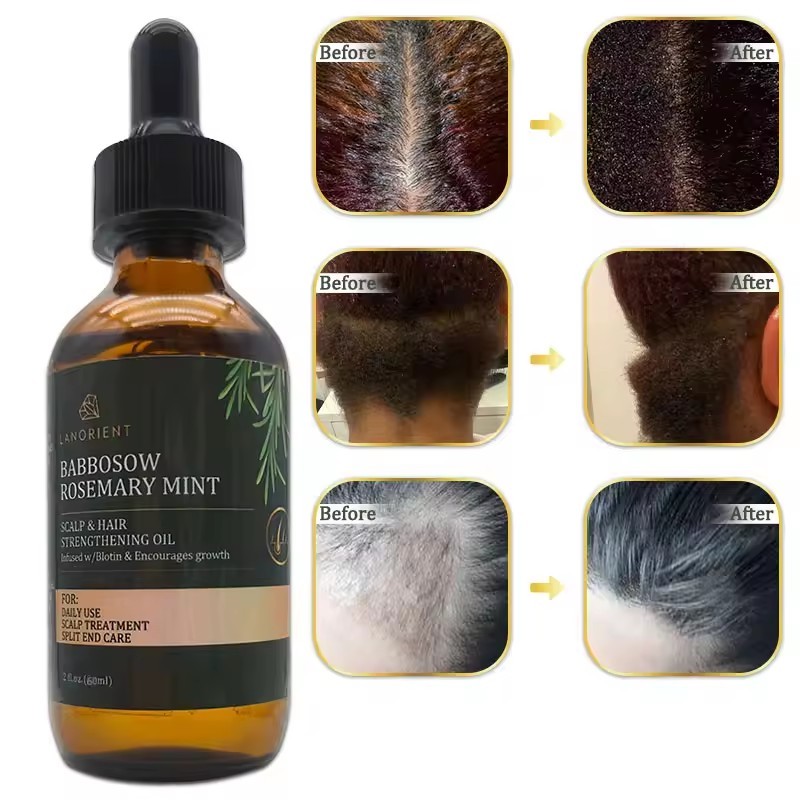 Private Label LANORIENT Organic Repair Hair Damage Improve Smoothness Promote Hair Growth Rosemary Oil