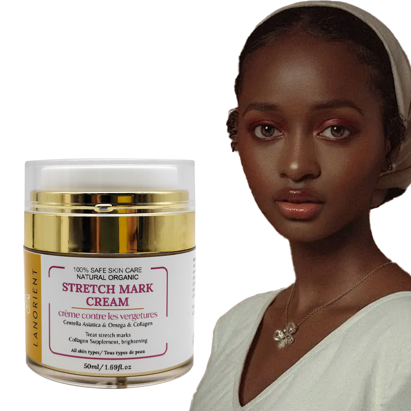 Private Label Natural Organic Body Care Products Vitamin E Rose Hip Oil Stretch Mark Removal Cream for Women