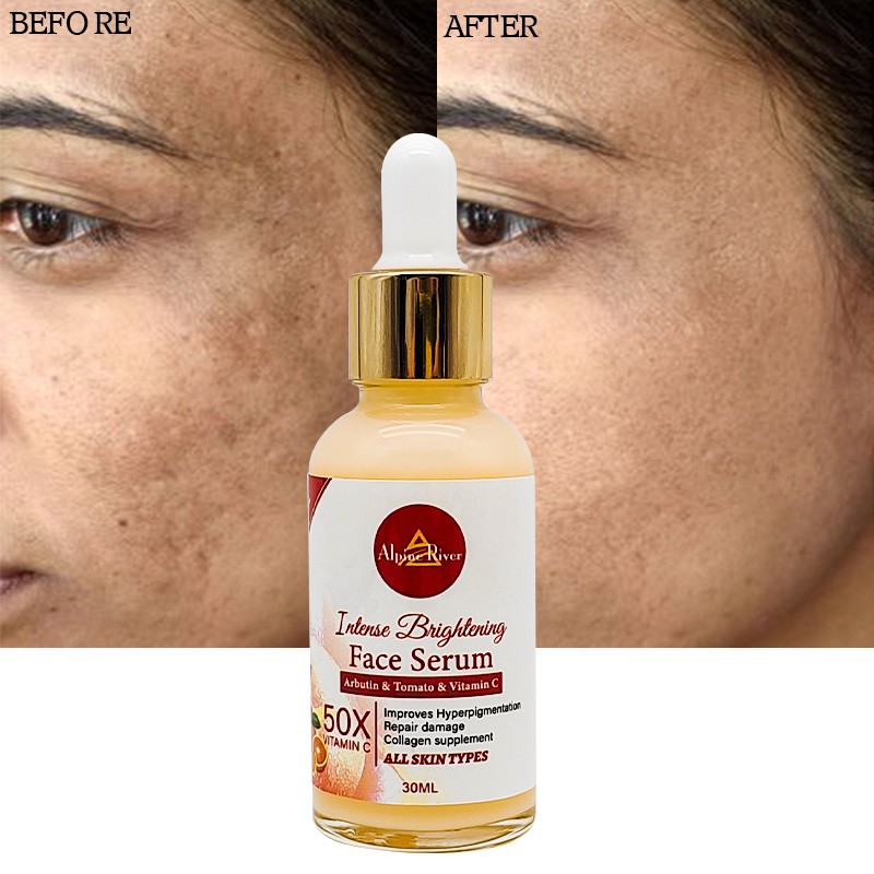 Private Label Vitamin C Korean Skin Whitening and Dark Spot Removal Arbutin Tomato Skin Care Serum for Women