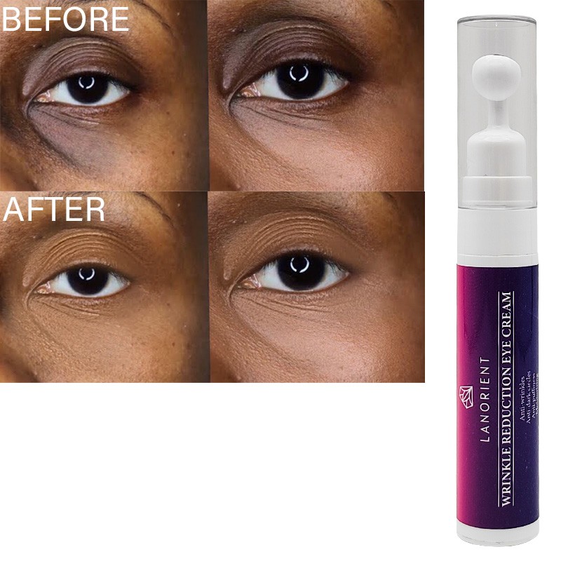 OEM Wholesale Vitamin C Facial Care Products Eye Bag Removal Cream Anti-Wrinkle Removal Retinol Ball Eye Cream for Adults