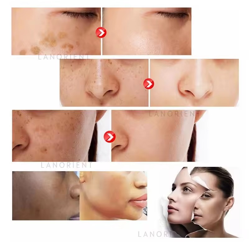 OEM Wholesale Natural Organic Health Supplement Glutathione Gummies Gummy Candies for Skin Whitening and Dark Spot Removal