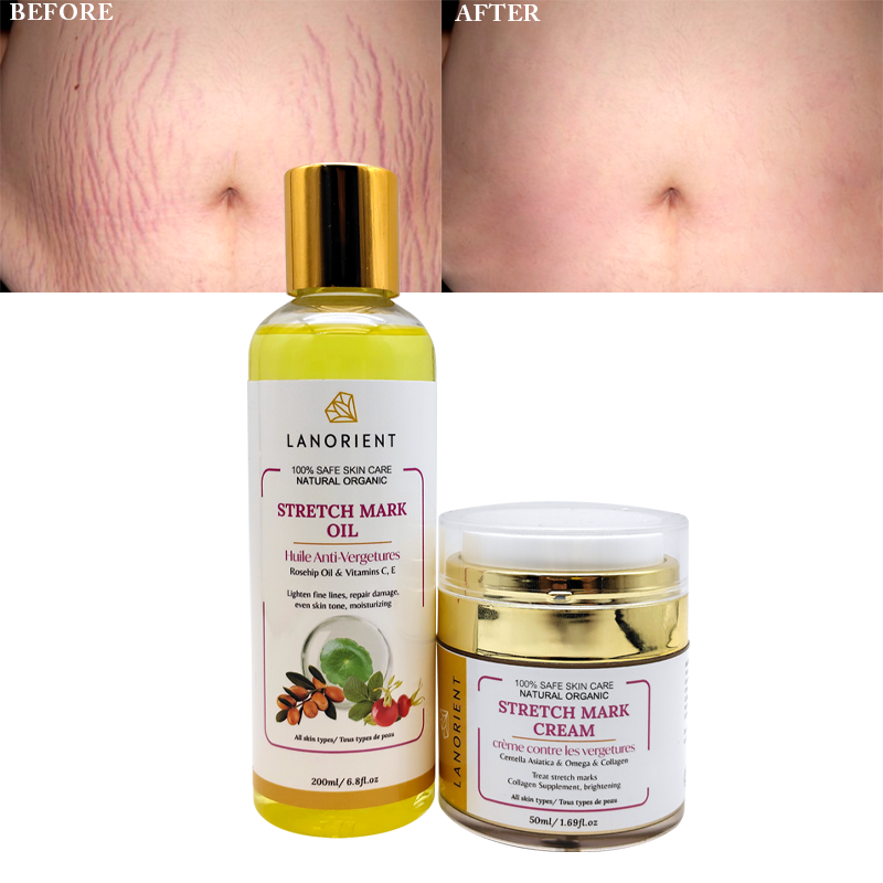 Private Label 100% Natural Organic Body Massage Oil Stretch Mark Removal Skin Repair Stretch Mark Cream for Women