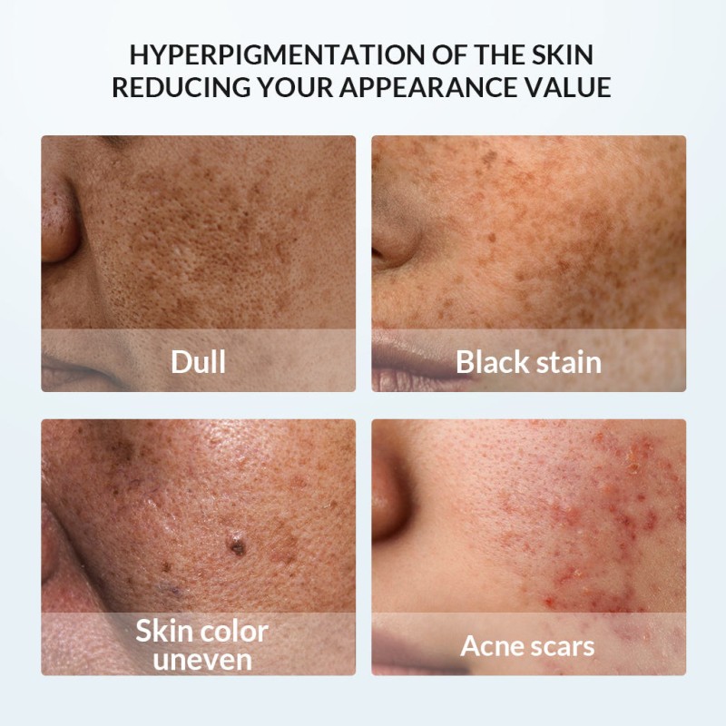 Private Label Vegan Skincare Kit Anti-Aging Acne Serum & Moisturizing Face Cream Whitening Facial Cleanser Set