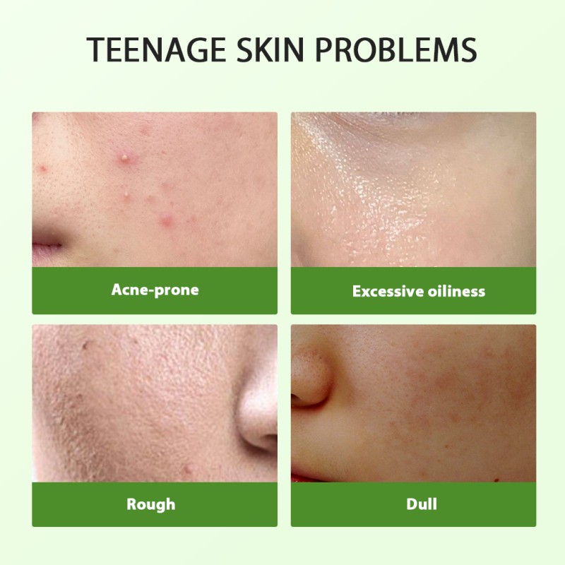 OEM ODM Private Label Women's Skin Care Set Tea Tree Oil Control and Shrink Pores Acne Barrier Facial Oil for Face Use