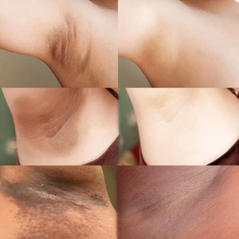 Wholesale Pearl Lightening Moisturizer Instant Smoothing Skin Bleaching Body Lotion Effective Underarm Whitening Cream Care Set