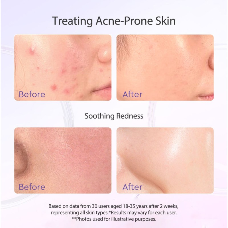 OEM ODM Blueberry Ceramide Low PH Gel Facial Cleanser Skin Repair Ance Foaming Face Wash Set for Skin Care