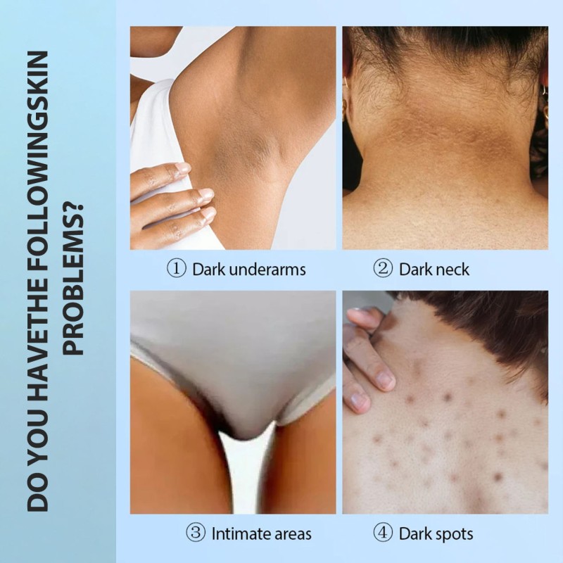 Best Private Label OEM Lightening Cream for Body Oem Whitening Cream Dark Spots Eraser Spotless Remover for Underarm Bikini