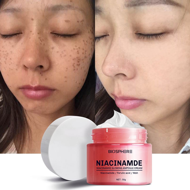 Bulk Vegan Firming Whitening Facial Cream for Dark Skin Niacinamide Anti-Aging Face Cream Camellia Main Ingredient Skin Care Set