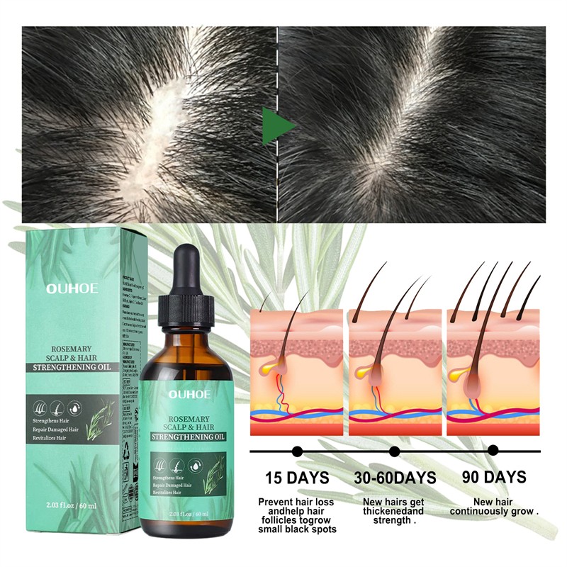 OUHOE 60ml Rosemary Scalp Hair Strengthening Oil Hair Strengthening Revitalizing Repairing Alopecia Balding Improving Oil