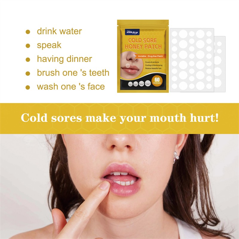 South Moon 60pcs Cold Sore Honey Patches Mouth Ulcer Herpes Abscess Swelling Long Bister Canker Relieving Patch