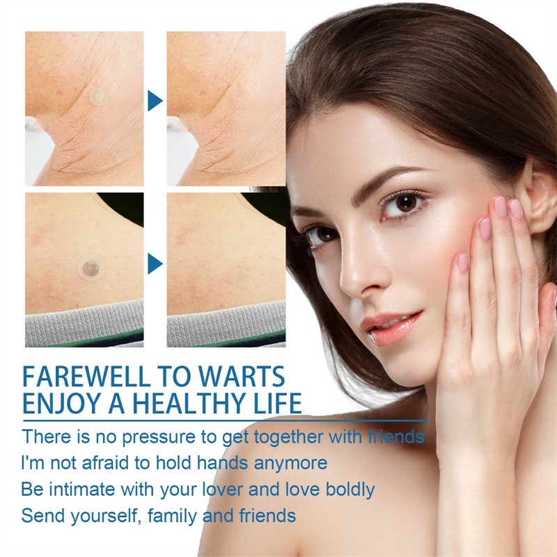 West Month 180pcs Skin Tag Removal Patches Finger Face Feet Arm Verruca Removing Skin Tag Wart Remover Patches