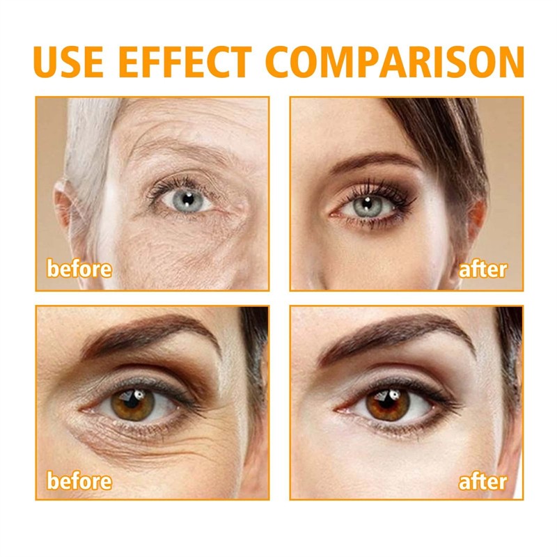 HOYGI 15ml 5D Peptide Anti Aging Eye Repair Cream Anti Wrinkle Fine Lines Smoothing Dark Circles Fading Eye Repairing Cream