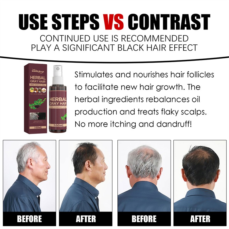 South Moon 100ml Herbal Gray Hair Verse Essence Spray White Hair Improving Hair Blackening Liquid