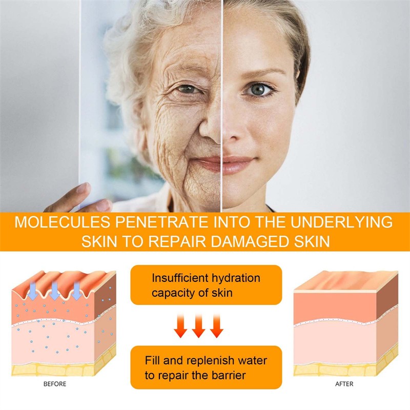 HOYGI 15ml 5D Peptide Anti Aging Eye Repair Cream Anti Wrinkle Fine Lines Smoothing Dark Circles Fading Eye Repairing Cream