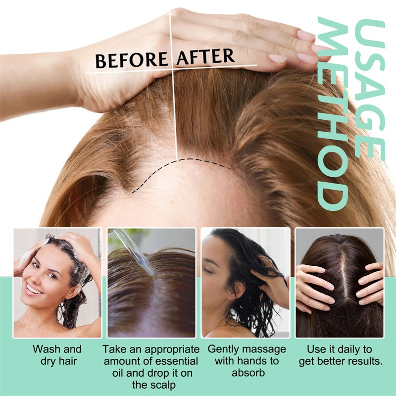 OUHOE 60ml Rosemary Scalp Hair Strengthening Oil Hair Strengthening Revitalizing Repairing Alopecia Balding Improving Oil