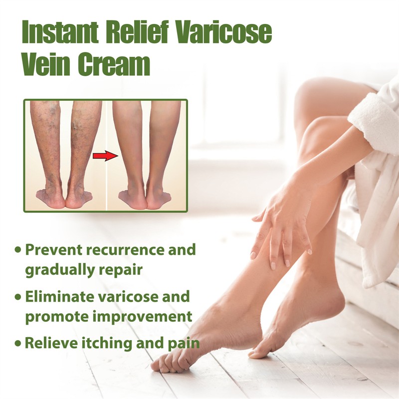 South Moon Best Instant Relief Varicose Vein Cream Soreness Swelling Earthworm Leg Relieving Spider Vein Removal Cream