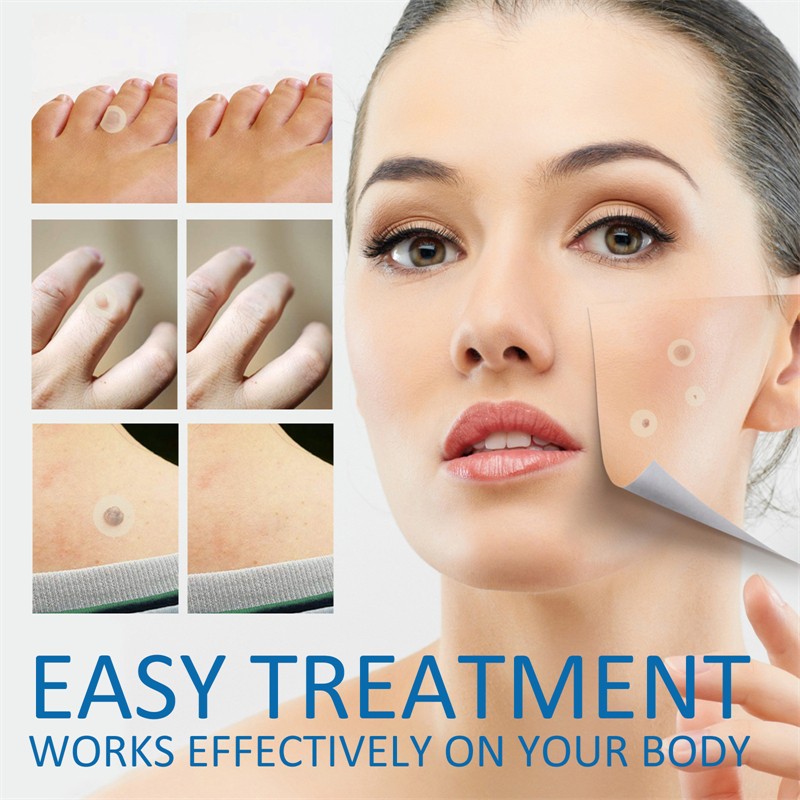 West Month 180pcs Skin Tag Removal Patches Finger Face Feet Arm Verruca Removing Skin Tag Wart Remover Patches