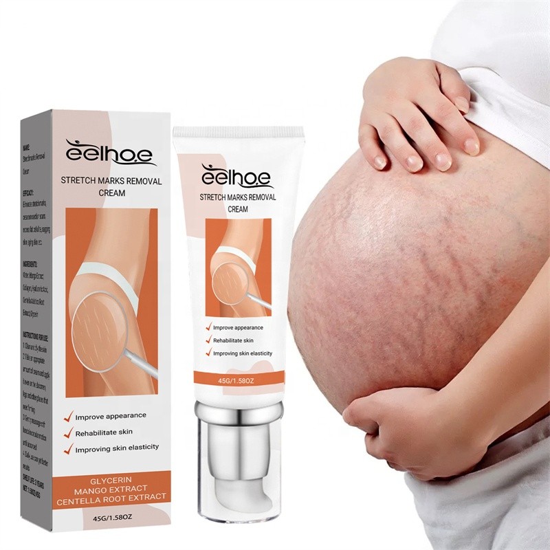 EELHOE 45g Stretch Marks Removal Cream Post Pregnancy Trace Removing Effective Stretch Mark Cream