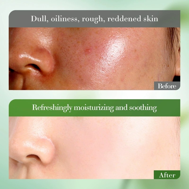 BIOAOUA Aloe Vera Soothing Moisturizing Six Piece Set Hydrating Soothing Face Cream Cleanser Toner Serum Eye Cream Kit