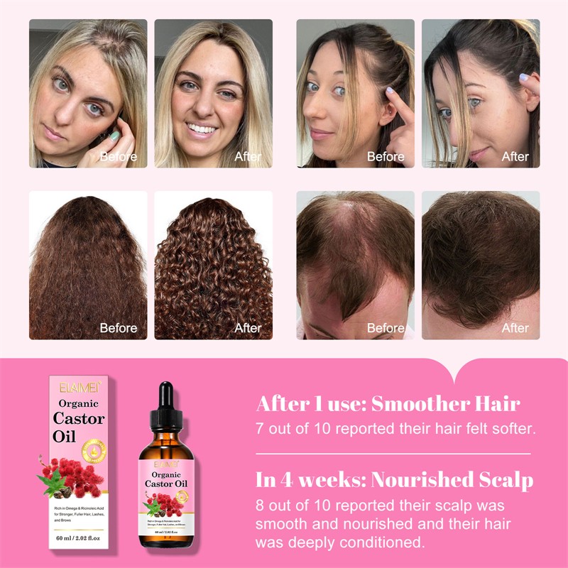 ELAIMEI Organic Cold Pressed Castor Oil Hair Growth Promoting Lash Brow Thicker SEFUDUN Pure Castor Oil Cold Pressed Hexane Free