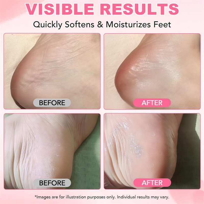 ELAIMEI Peach Aloe Cracked Heel Stick Moisturizing Softening Smoothing Exfoliating Elbow Palm Hand Knee Feet Cream Stick