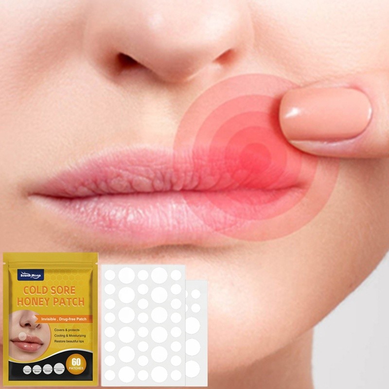 South Moon 60pcs Cold Sore Honey Patches Mouth Ulcer Herpes Abscess Swelling Long Bister Canker Relieving Patch
