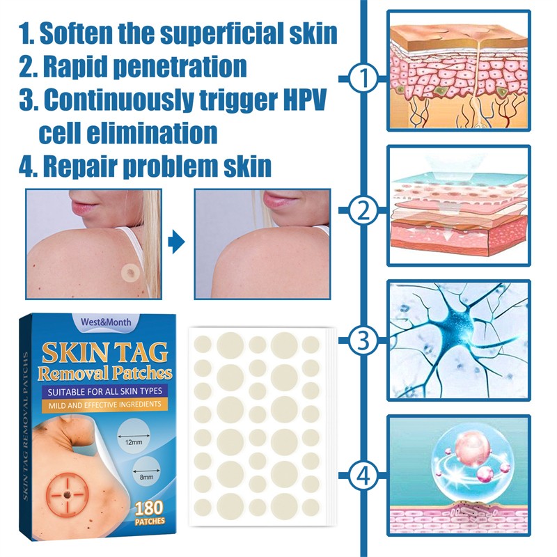 West Month 180pcs Skin Tag Removal Patches Finger Face Feet Arm Verruca Removing Skin Tag Wart Remover Patches