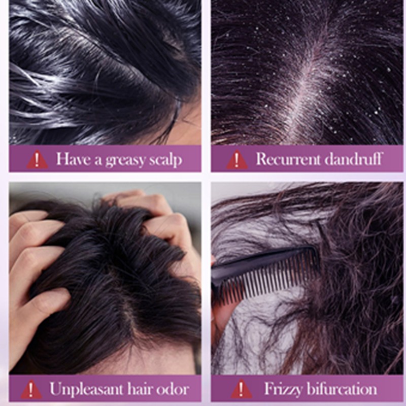 Sadoer 500ml Cleansing Softening Smoothing Roughness Improving Split Ends Reducing Onion Black Seed Oil Volumizing Hair Shampoo