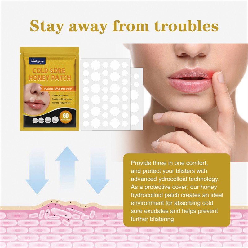 South Moon 60pcs Cold Sore Honey Patches Mouth Ulcer Herpes Abscess Swelling Long Bister Canker Relieving Patch