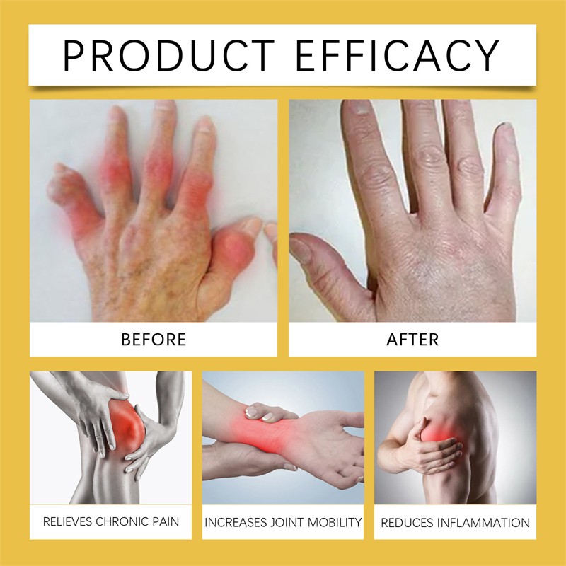 HOUKEA 30g Bee Venom Bone Joint Cream Moisturizing Nourishing Soothing Swelling Reducing Muscle Joint Pain Relief Cream