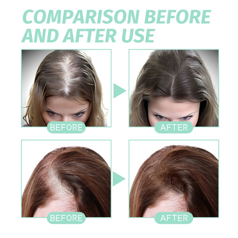 OUHOE 60ml Rosemary Scalp Hair Strengthening Oil Hair Strengthening Revitalizing Repairing Alopecia Balding Improving Oil