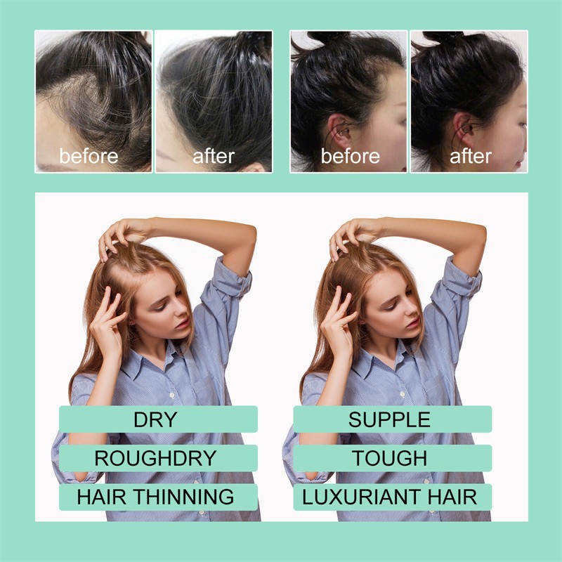 OUHOE 60ml Rosemary Scalp Hair Strengthening Oil Hair Strengthening Revitalizing Repairing Alopecia Balding Improving Oil