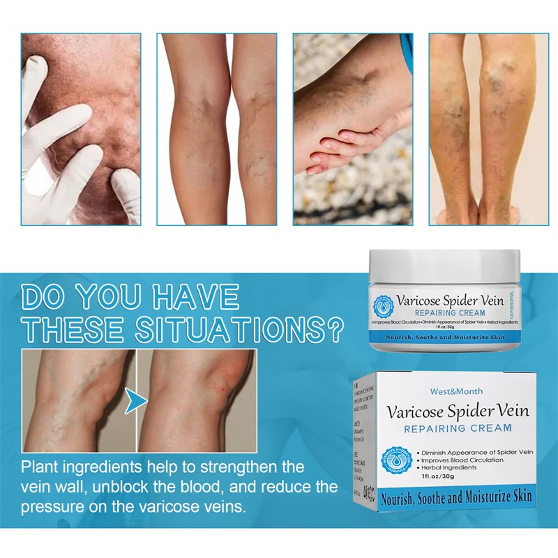 West Month Varicose Spider Vein Repairing Cream Nourishing Soothing Moisturizing Chinese Anti Varicose Vein Cream