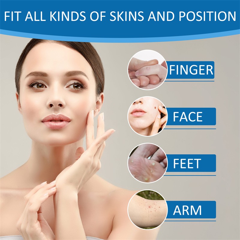 West Month 180pcs Skin Tag Removal Patches Finger Face Feet Arm Verruca Removing Skin Tag Wart Remover Patches