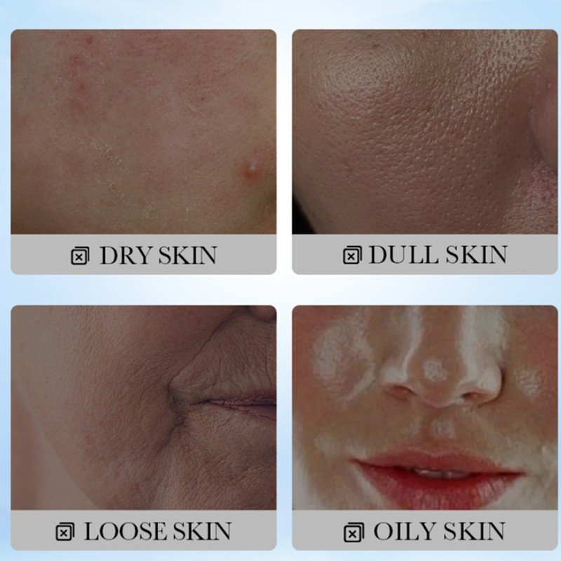 Sadoer Coconut Oil Six Piece Set Moisturizing Nourishing Brightening Face Cream Cleanser Toner Lotion Serum Eye Cream Set