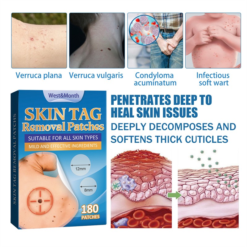 West Month 180pcs Skin Tag Removal Patches Finger Face Feet Arm Verruca Removing Skin Tag Wart Remover Patches