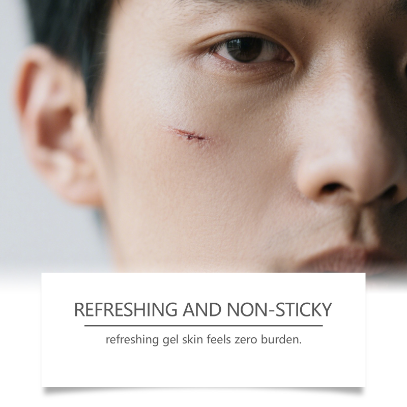 South Moon Herbal Skin Care Gel Pen Body Nourishing Smooth Refreshing Scar Removal Cream Aloe Vera Gel