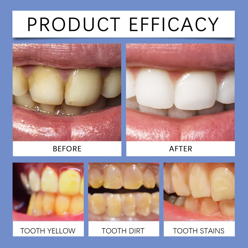 ORALHOE Whitens Teeth Frender Corn Starch Mint Extract Deep Cleaning Fresh Breath Tooth Powder Smooth Teeth With Spoon