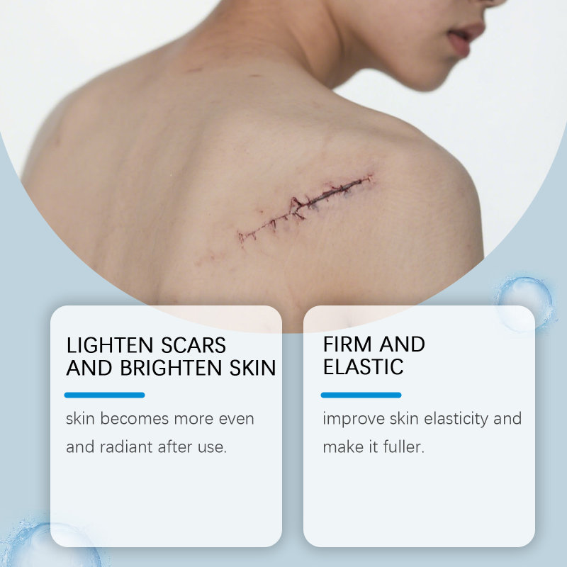 South Moon Herbal Skin Care Gel Pen Body Nourishing Smooth Refreshing Scar Removal Cream Aloe Vera Gel