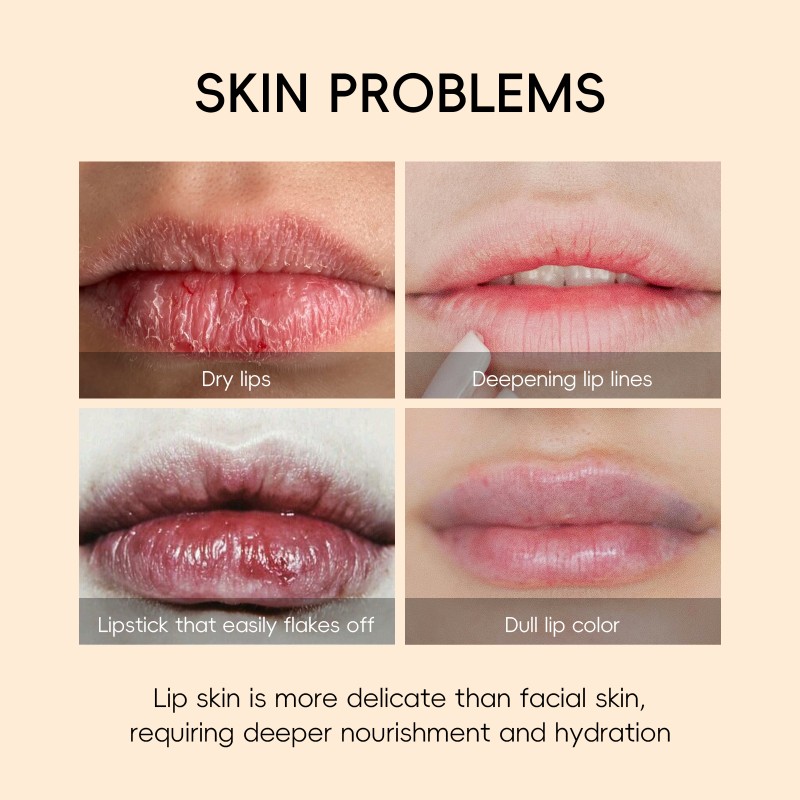 LAIKOU Vitamin C Jelly Overnight Lip Mask Custom Label Individual Pack Quick Film Lock in Nutrients Lip Care Makeup Primer