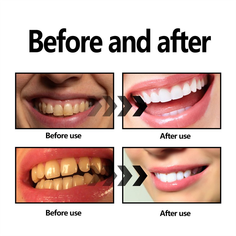 EELHOE 30g Activated Coconut Charcoal Teeth Whitening Powder Yellow Teeth Stains Bad Breath Removing Powder Whitener for Teeth