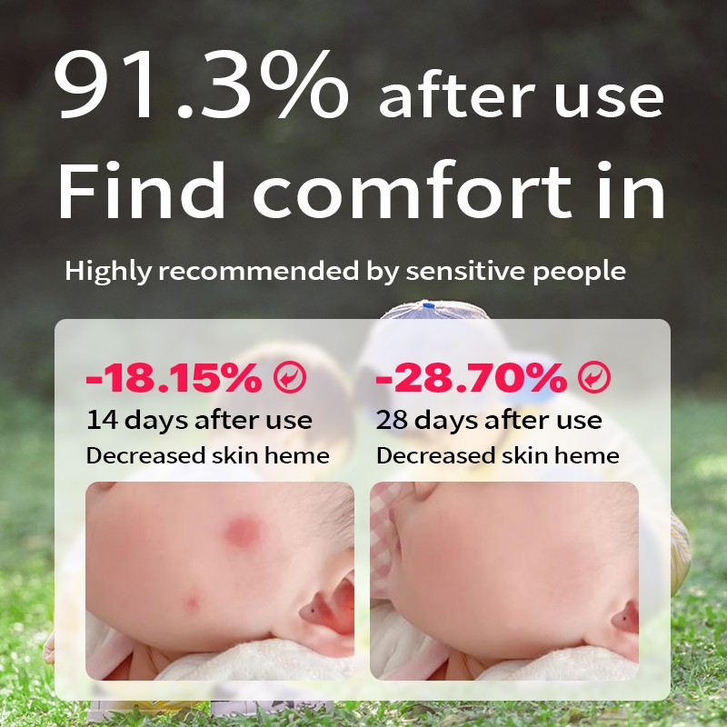 OEM Herbal Soothing Roll-On Gel 30ml / 1 Fl oz Cooling Relief Herbal Ingredients Effective Itch Relief Purple Root Roll-On Gel