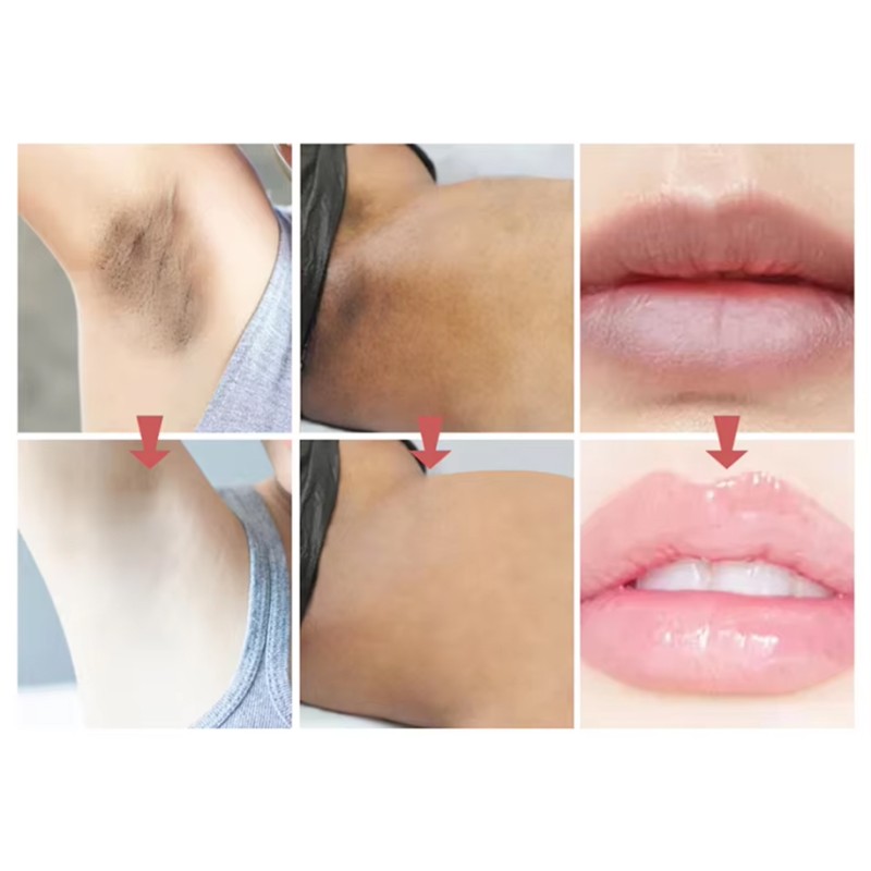 Vegan Herbal Underarm Intimate Area Whitening Lotion for Women Gentle Bleaching Lightening Nipple Vaginal Lips Pinkening